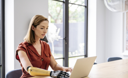A woman using a prosthetic limb working on a computer
